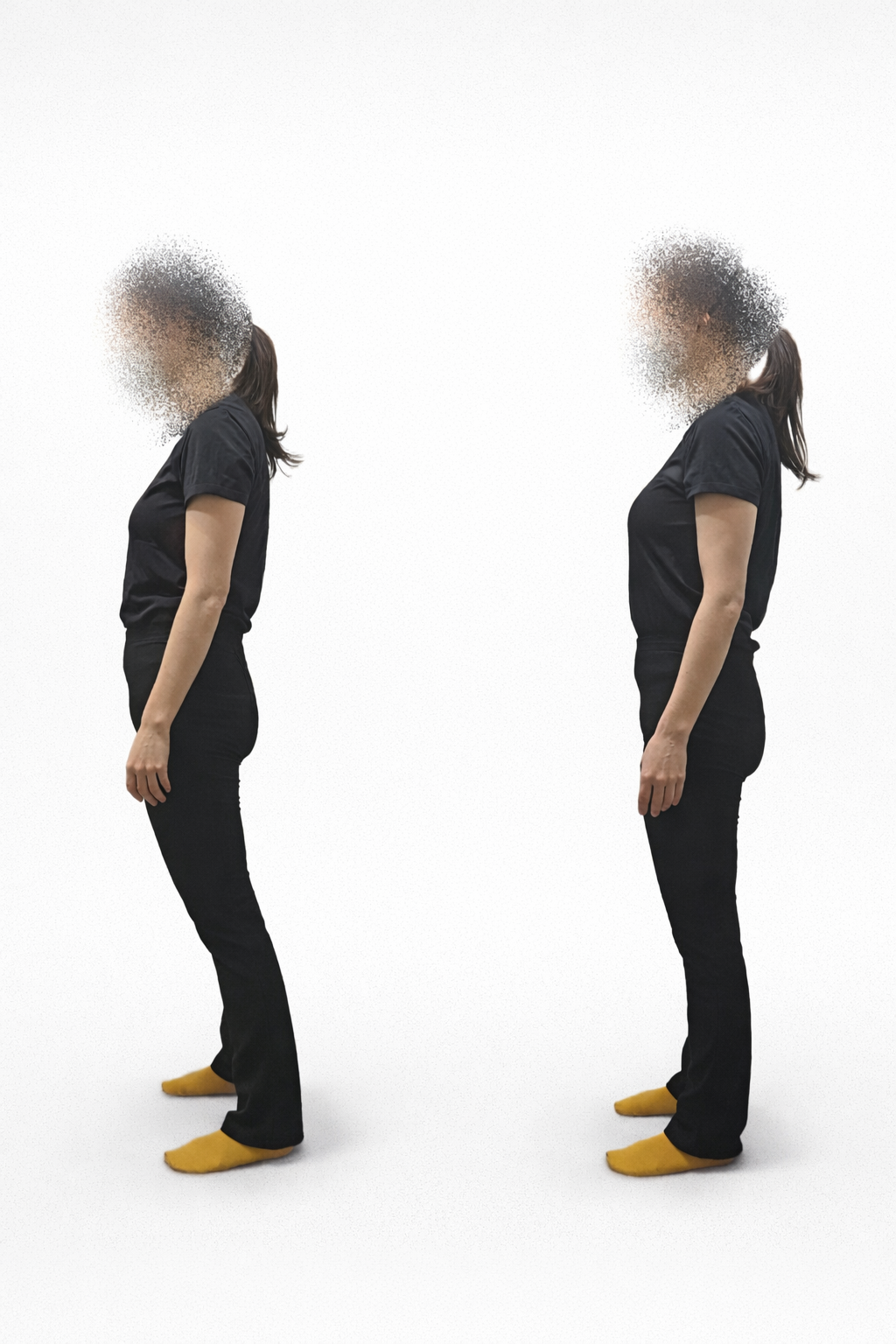 施術前後の姿勢変化